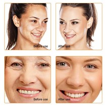 뉴당근 에센스 에센셜 오일 다크 스팟 코렉터 페이스 화이트닝 세럼 브라이트닝 잡티 주근깨 리무버 100%, 03 10ml