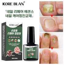 KORELAN 발톱무좀 발톱무좀 치료 손발톱 관리 앰플 손톱 영양제, 2개, 15ml