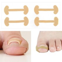 내향성 내성발톱 교정테이프 염증 자가치료 2개 추석