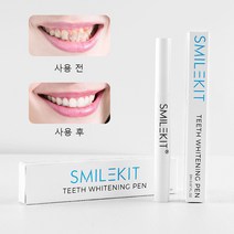 셀프 치아미백 치아미백겔 치아미백제, 2개