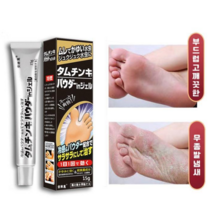 ANLAIHUI 발치료 가려움 악성체취 발냄새 발각질 완화 가려움 방지 살균 발 탈피 억제 연고, 15g, 1개, 1개