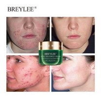 BREYLEE 여드름 크림 진정 수분 무자극 쿨링, 20g, 1개