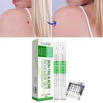 세럼사마귀 펜을 제거하는 2pcs 옥수수 고기 가시 스틱 퇴색 한 두더지 감소 36 석고 바디 마크 피부 조각, 01 3ml