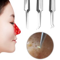 엔템 블랙헤드제거 얼굴피지제거 홈케어 얼굴 여드름 프라즈마 가정용 피부관리기 기미제거 피지제거 남자 여자 피지제거기 핀셋, 피지제거기-L형