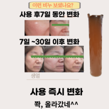 천잠신기한 비누베이스1kg 중성 스톤 오래쓰는 모공까지 잡아내는 스킨케어, 스톤 중성 비누베이스 11kg