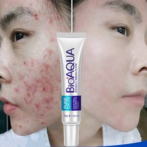 BIOAQUA 스킨 케어 얼굴 여드름 치료 흉터 크림 제거 젤 미백 보습 30g