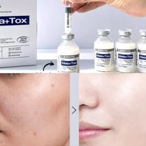 기미지우는 주사기 앰플/굵은주름 모공 리프팅에센스/미백관리 아이크림/재생에센스, 백옥앰플+아이보톡크림 2개