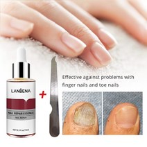 LANBENA 1+1 발톱무좀치료 발톱무좀 진균 리페어에센스 조갑사상균증 손발톱 강화리페어, 30ML