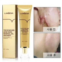 LANBENA 흉터제거연고 리페어 상처 재생크림, 30g, 1개