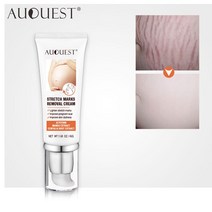AUQUEST-스트레치 마크 리무브 크림 임산부용 출산 스카 트러블 리무버 방지 에이징 스킨 퍼밍 크림 바디 케어 45g, CN