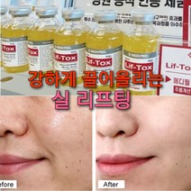 마린레티놀 콜라겐실 굵은주름 리프팅 앰플 또는 줄기세포마스크 또는 보톡싱 아이크림 택1 또는 세트상품, 3%)레티놀 콜라겐실 앰플1+피부과 원장님아이크림2