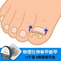 내성발톱교정기 정형 네일 그루브 임베디드 특수 교정기 발톱 교정 스티커 롤 롱 고기 염증 패치, [20] 8종 세트  코바늘 5종 추천