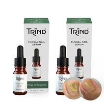 (유럽직수입 트린드) 펑거스 네일세럼 10ml 손상된 문제성 발톱 영양제 발톱관리 케어제품, 2개