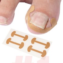 내성발톱 관리 케어 교정 보호 테이프 4P
