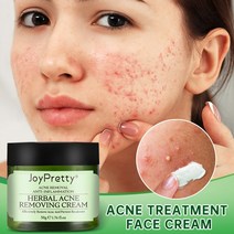 JoyPretty-트러블 페이스 크림 허브 트러블 스카 진정 모공 수축 오일 컨트롤 모이스처라이징 페이셜 크림 트러블 치료 스킨 케어, 01. Acne Cream 50g