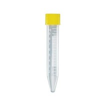 Globe Scientific 6293 노란색 나사 캡이 부착된 폴리프로필렌 범용 원심분리기 튜브 멸균 10mL 용량 1000개 케이스