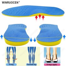 생안발발톱꼬임교정패치 족저근막염실내화 평발슬리퍼 자세교정 Winruocen ox leg valgus varus 정형 외과 안창 발 아치 지원 마사지 통증 활 신발 패드 용 신발, xl 나 44-46