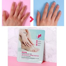 손 손톱 가시래기 까시래기 2회분 주변 굳은살 연화제 거스러미 오일 세로줄 갈라짐 영양제