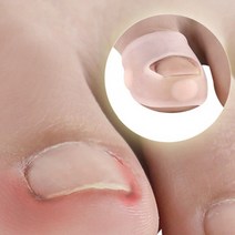 실리콘 내성발톱교정기 밴드 내성발톱 교정 테이핑