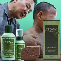 아토피를 위한 100% 비건 제품 가려움증 없애줘요, 비누