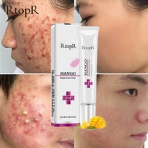 트러블 치료 페이스 크림 블랙 헤드 리페어 젤 오일 컨트롤 수축 모공 스카 화이트닝 모이스처 라이저 스킨 케어 한국 화장품, 01. 1