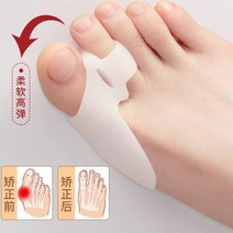 발가락 교정기 교정 검지 무지외반 엄지 평발 외반 는 큰 어미 머리와 발로 나누어 큰, 3 쌍 스킨 컬러 + 화이트 + 화이트, 한 사이즈