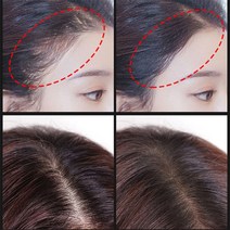 두피 에센스 영양제 줄기 세포 성장 혈청 안티 탈모 28 일 빠른 방지 가위 2 개/대 헤어 케어 에센스, 01 Hair Growth Serum