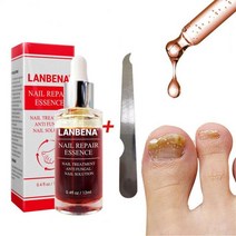 네일아트 LANBENA-곰팡이 손톱 수리 세럼 케어 트리트먼트 발 곰팡이 제거 젤 손발톱 진균증 방지, 01 as picture