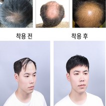 남성 원형 가발 정수리 자연스러운 부분 똑딱이 티 안나게 숱이 없는 머리 360도 커버 휑한 두피 M자 엠자 탈모 가르마 남자 반가발 앞 뒷머리 옆머리 흰머리 새치 인조모 고급, 자연앞머리타입-대