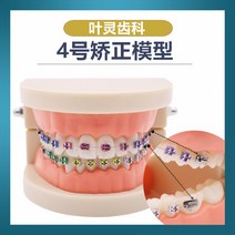 관리 강의 설명용 개원 고급형 양치 입모형 이빨 덴티폼 구강 치과 임플란트 치아모형, 4번  모형
