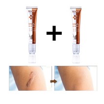 JIENASI 1+1 흉터제거연고 피부 흉터 치료 제왕절개 흉터 수술 화상 상처, 20g, 2개