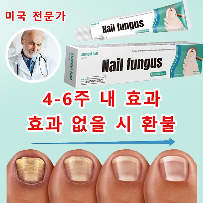 손발톱 항균 크림, 빠른 곰팡이 케어 손상된 손발톱손발톱바닥 회복 연고, 20g, 3개