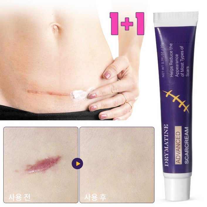 당일배송 DRYMATINE 흉터연고 흉터제거연고 재생크림 상처흉터연고 여드름흉터 수술흉터 화상물집 흉터제거연고 20g
