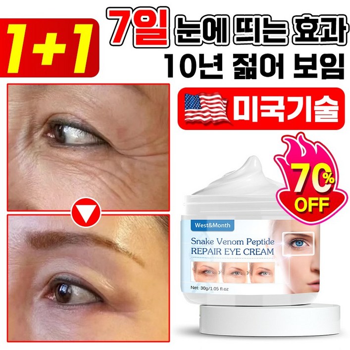 독일기술 1+1 루테인 5분 아이백크림 50대이상 눈밑 지방 꺼짐 미간 눈가 이마 팔자 주름 개선 다크서클 제거 리프팅 단백질 콜라겐 링클 아이크림