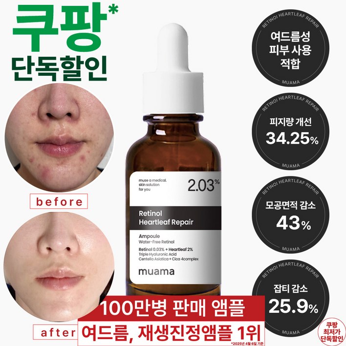 3일 여드름 재생진정 개선 앰플 [100만병 판매기념 단독 선착순 최저 할인] [여드름 흉터 & 좁쌀 피지 개선 임상완료] 레티놀 어성초 히알루론산 나이아신아마이드 뮤아마 앰플, 1개, 30ml
