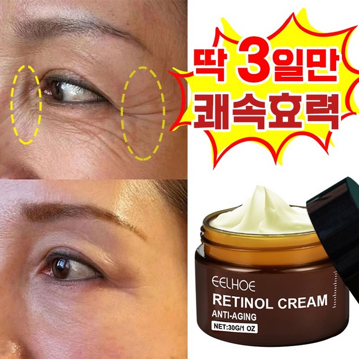 [빠른배송] 주름 개선 재생 레티놀 크림 모공수축 팔자 목 눈밑 주름 크림 탄력 영양 미간 눈가 수분크림