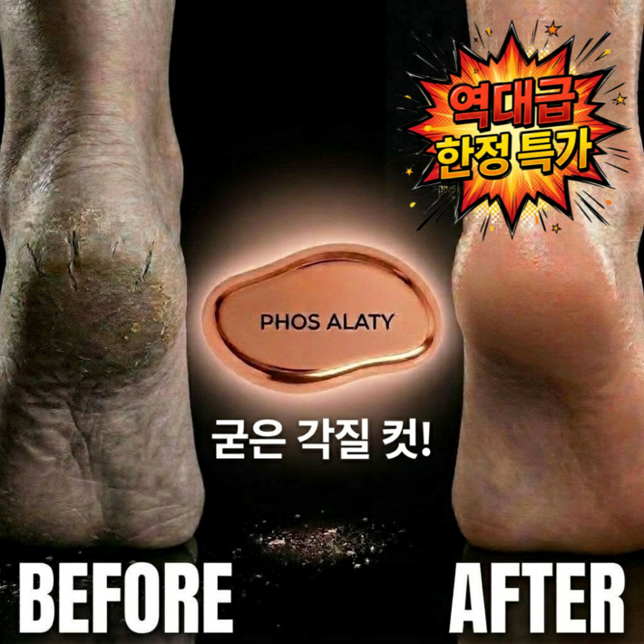 포스알라티 발각질제거기 스톤 명품