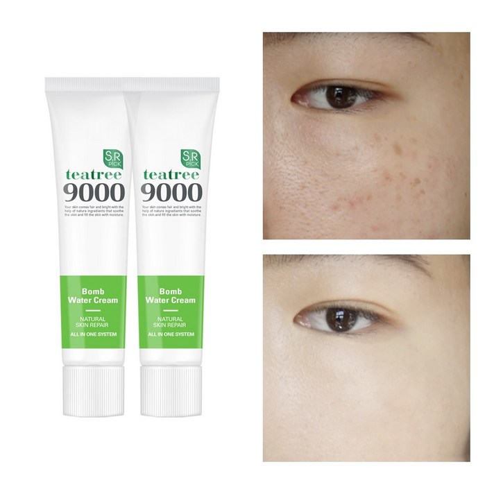 색소토닝크림 기미 잡티 착색 색소침착 검버섯 주근깨 수분 보습 티트리 재생 화이트닝 미백 크림, 2개, 50ml