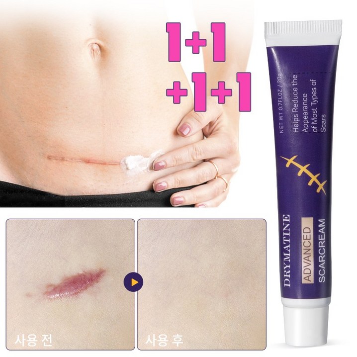 당일배송 DRYMATINE 흉터연고 흉터제거연고 재생크림 상처흉터연고 여드름흉터 수술흉터 화상물집 흉터제거연고, 4개, 20ml 당일배송 DRYMATINE 흉터연고 흉터제거연고 재생크림 상처흉터연고 여드름흉터 수술흉터 화상물집 흉터제거연고, 4개, 20ml