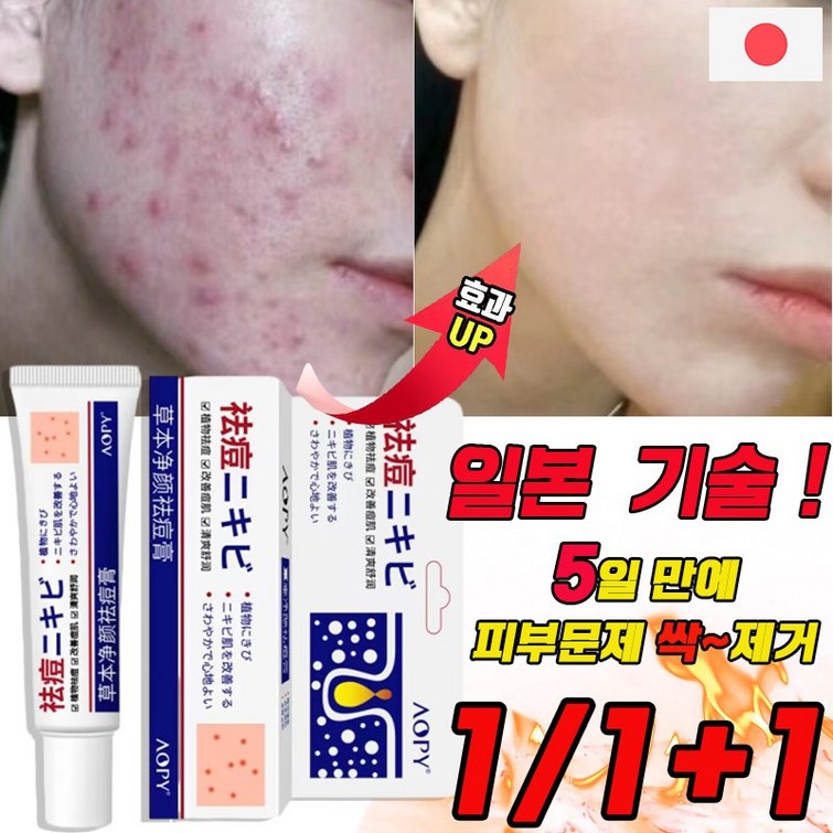 국내배송 여드름 연고 흉터 치료 지루성피부염 제거 리페어 연고 문제피부 자국 모공 진정 피지케어 크림